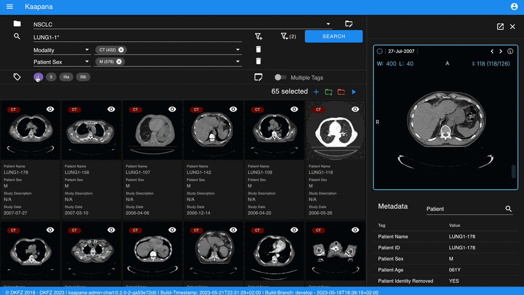 Tagging items in the gallery view